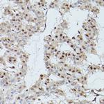 CDK9 Polyclonal Antibody