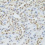 ILK Antibody in Immunohistochemistry (Paraffin) (IHC (P))