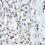 C/EBP alpha Polyclonal Antibody