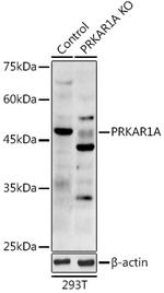 PRKAR1A Antibody in Western Blot (WB)