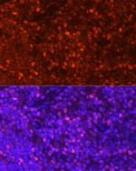 LEF1 Polyclonal Antibody