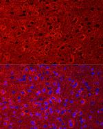 GLT-1 Polyclonal Antibody