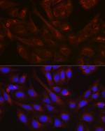 NSF Antibody in Immunocytochemistry (ICC/IF)