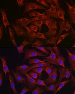 MARCKS Polyclonal Antibody