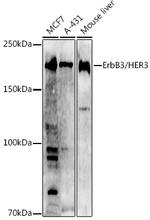 ErbB3 Polyclonal Antibody