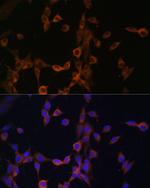 Calcineurin B Polyclonal Antibody