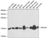 Calcineurin B Antibody in Western Blot (WB)