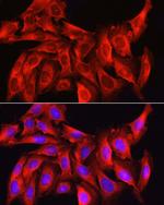 Caspase 1 Antibody in Immunocytochemistry (ICC/IF)