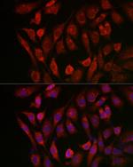 Cathepsin B Antibody in Immunocytochemistry (ICC/IF)
