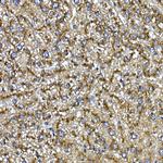 Cathepsin B Antibody in Immunohistochemistry (Paraffin) (IHC (P))