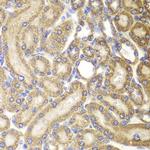HSP60 Antibody in Immunohistochemistry (Paraffin) (IHC (P))