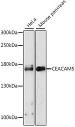 CEACAM5 Antibody in Western Blot (WB)