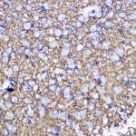 SNAP25 Antibody in Immunohistochemistry (Paraffin) (IHC (P))