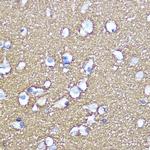 SNAP25 Antibody in Immunohistochemistry (Paraffin) (IHC (P))