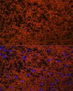 SNAP25 Antibody in Immunohistochemistry (Paraffin) (IHC (P))