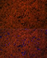 SNAP25 Antibody in Immunohistochemistry (Paraffin) (IHC (P))
