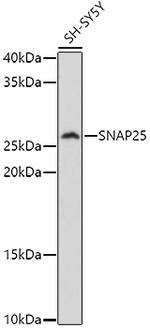 SNAP25 Antibody in Western Blot (WB)
