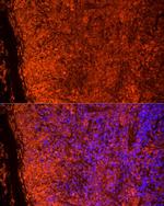 TLR7 Antibody in Immunocytochemistry (ICC/IF)