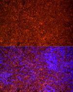 TLR7 Antibody in Immunocytochemistry (ICC/IF)
