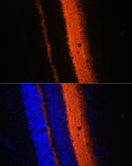 Synaptotagmin 1 Polyclonal Antibody
