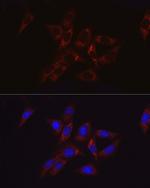 HK2 Polyclonal Antibody