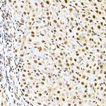 ID2 Antibody in Immunohistochemistry (Paraffin) (IHC (P))