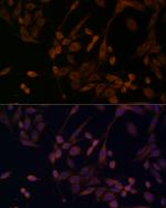 beta Arrestin 1 Antibody in Immunocytochemistry (ICC/IF)