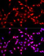 KLF6 Polyclonal Antibody
