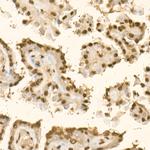 KLF6 Antibody in Immunohistochemistry (Paraffin) (IHC (P))