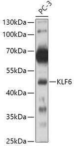 KLF6 Antibody in Western Blot (WB)