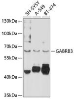 GABRB3 Polyclonal Antibody