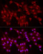 YAP1 Antibody in Immunocytochemistry (ICC/IF)