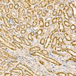 MCCC1 Polyclonal Antibody