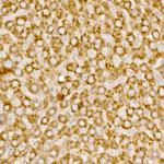 MCCC1 Antibody in Immunohistochemistry (Paraffin) (IHC (P))