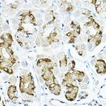 LRRC59 Antibody in Immunohistochemistry (Paraffin) (IHC (P))