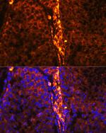 RBP1 Antibody in Immunohistochemistry (Paraffin) (IHC (P))