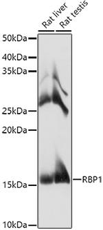 RBP1 Antibody in Western Blot (WB)