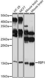RBP1 Antibody in Western Blot (WB)