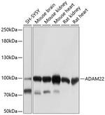 ADAM22 Polyclonal Antibody