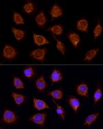 SUCLA2 Antibody in Immunocytochemistry (ICC/IF)