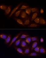 SUCLA2 Polyclonal Antibody