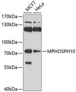 MPP10 Polyclonal Antibody