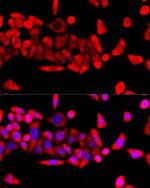 RPL8 Antibody in Immunocytochemistry (ICC/IF)