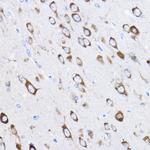RPL8 Antibody in Immunohistochemistry (Paraffin) (IHC (P))