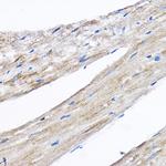 RPL8 Antibody in Immunohistochemistry (Paraffin) (IHC (P))