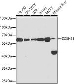 ZC3H15 Antibody in Western Blot (WB)