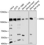 DDR2 Polyclonal Antibody