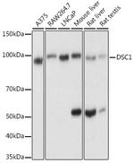 DSC1 Polyclonal Antibody