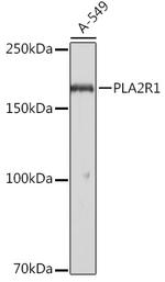 PLA2R1 Polyclonal Antibody
