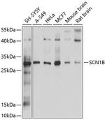 SCN1B Polyclonal Antibody